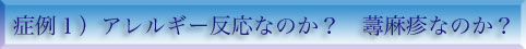症例１）アレルギー反応なのか？蕁麻疹なのか？