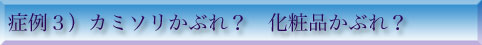 症例３）化粧品でかぶれる？アレルギー反応とは？